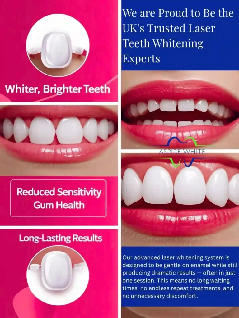 We are Proud to Be the UK’s Trusted Laser Teeth Whitening Experts Market Harborough